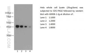 Proteintech 60008-1-Ig，beta Actin Monoclonal Anbody;Proteintech.60008-1-Ig;Tested applicaons: ELISA, WB, IF, FC, IHC ;