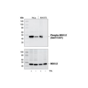 cst.9154T	Phospho-MEK1/2 (Ser217/221) (41G9) Rabbit mAb #9154	20ul